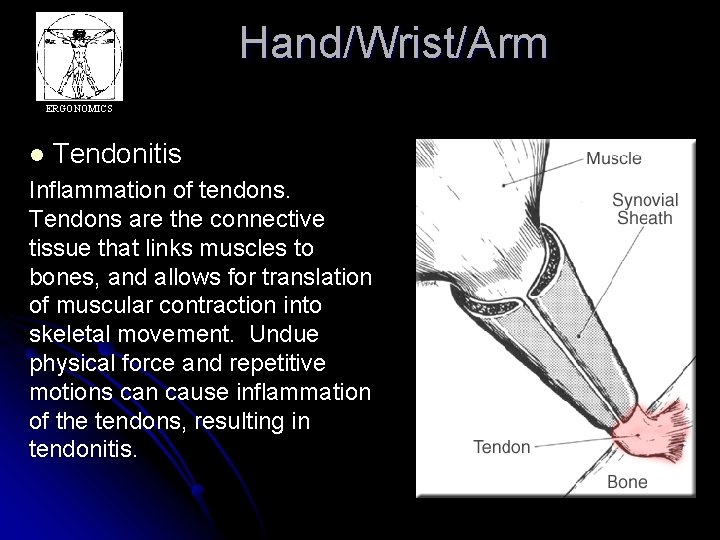 Hand/Wrist/Arm ERGONOMICS l Tendonitis Inflammation of tendons. Tendons are the connective tissue that links