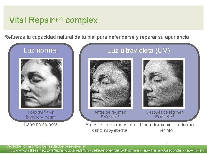 Vital Repair+® complex Refuerza la capacidad natural de tu piel para defenderse y reparar