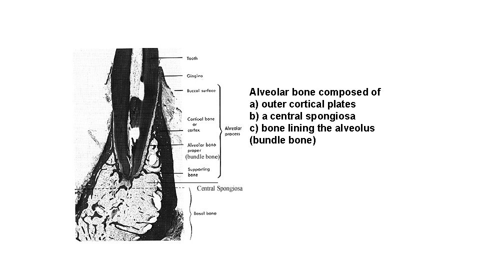 Alveolar bone composed of a) outer cortical plates b) a central spongiosa c) bone