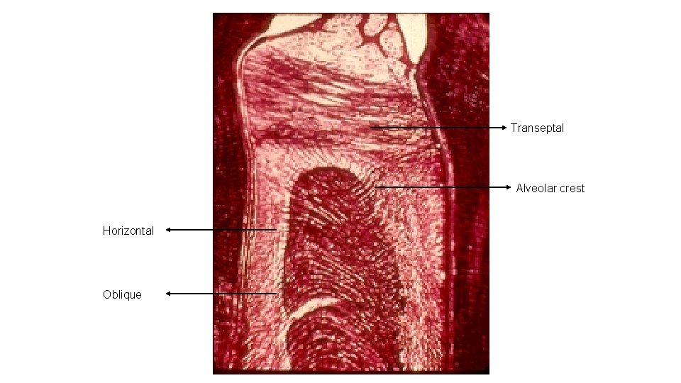 Transeptal Alveolar crest Horizontal Oblique 