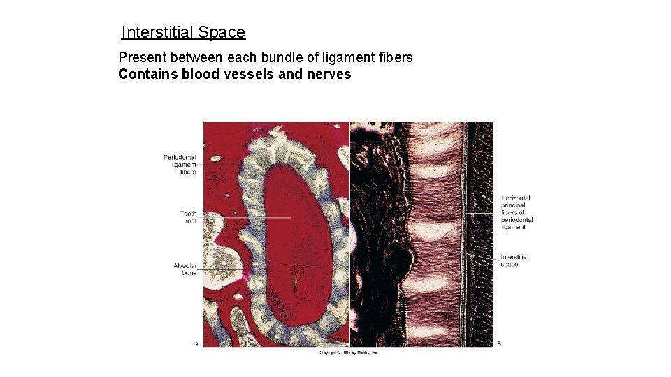 Interstitial Space Present between each bundle of ligament fibers Contains blood vessels and nerves