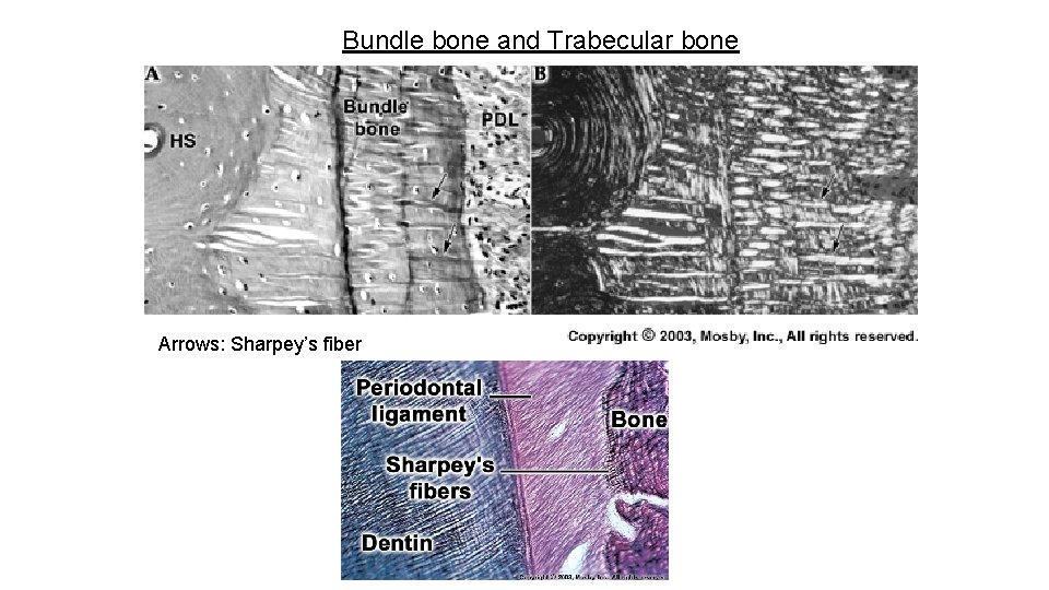 Bundle bone and Trabecular bone Arrows: Sharpey’s fiber 