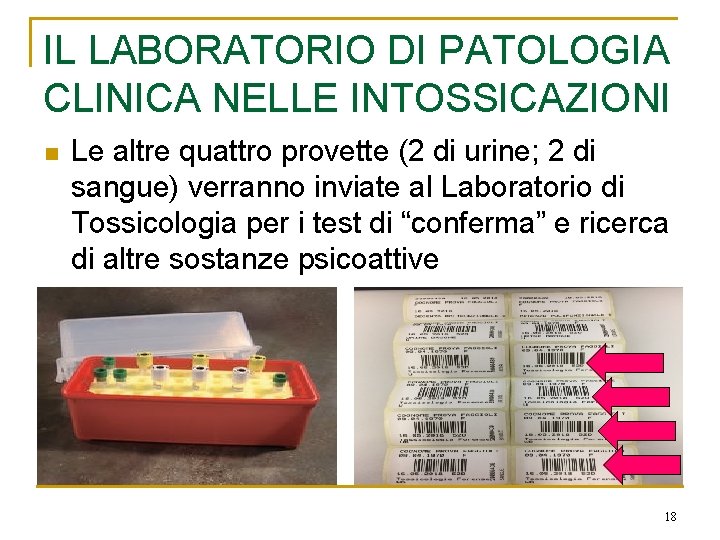 IL LABORATORIO DI PATOLOGIA CLINICA NELLE INTOSSICAZIONI n Le altre quattro provette (2 di