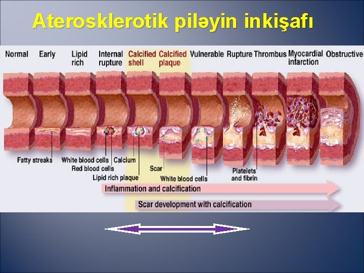 Aterosklerotik piləyin inkişafı 
