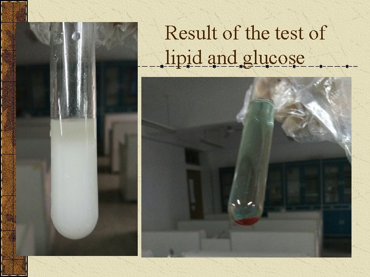 Result of the test of lipid and glucose 