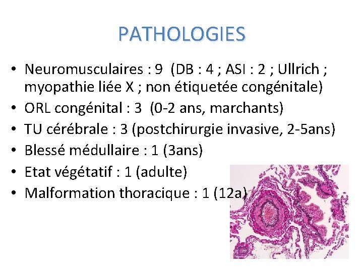 PATHOLOGIES • Neuromusculaires : 9 (DB : 4 ; ASI : 2 ; Ullrich
