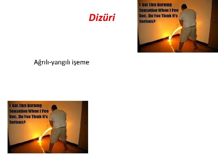 Dizüri Ağrılı-yangılı işeme 