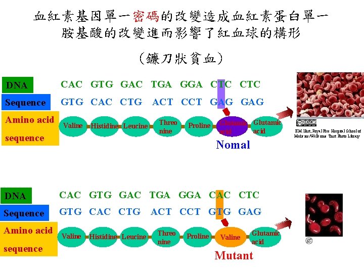 血紅素基因單一密碼的改變造成血紅素蛋白單一 胺基酸的改變進而影響了紅血球的構形 (鐮刀狀貧血) DNA CAC GTG GAC TGA GGA CTC Sequence GTG CAC CTG