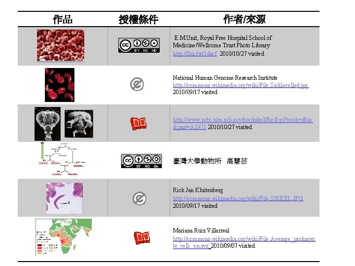 作品 授權條件 作者/來源 E. M. Unit, Royal Free Hospital School of Medicine/Wellcome Trust Photo