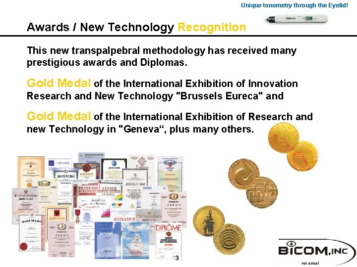 Unique tonometry through the Eyelid! Awards / New Technology Recognition This new transpalpebral methodology