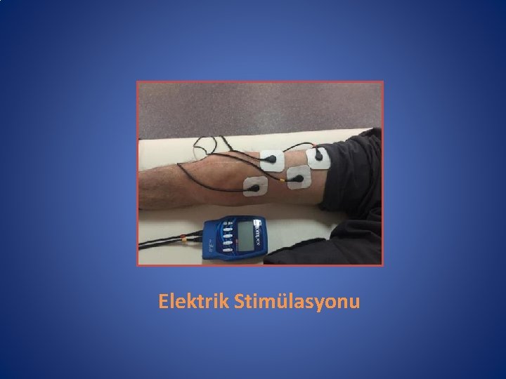 Elektrik Stimülasyonu 