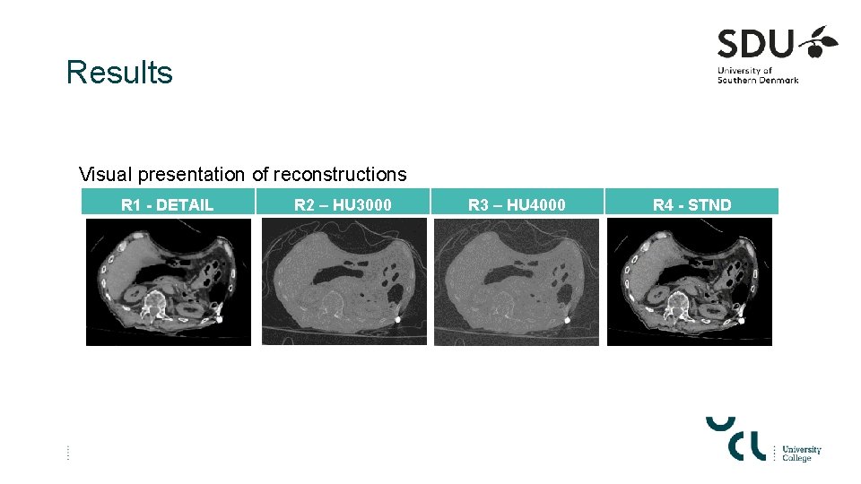 Results Visual presentation of reconstructions R 1 - DETAIL R 2 – HU 3000