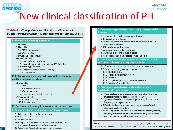 New clinical classification of PH 