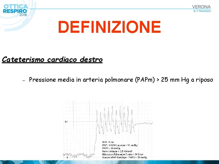 DEFINIZIONE Cateterismo cardiaco destro – Pressione media in arteria polmonare (PAPm) > 25 mm