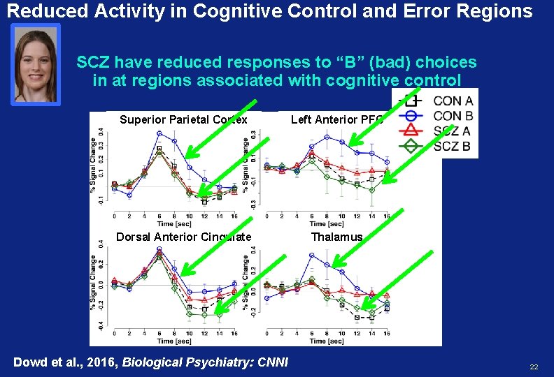 Reduced Activity in Cognitive Control and Error Regions SCZ have reduced responses to “B”