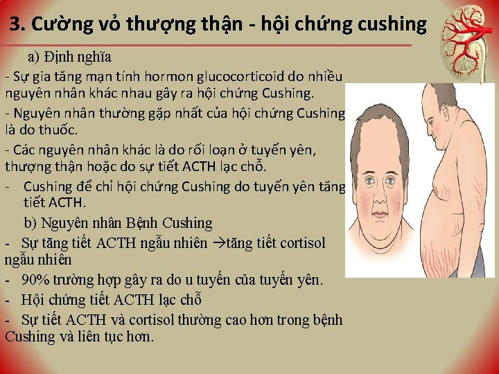 3. Cường vỏ thượng thận - hội chứng cushing a) Định nghĩa - Sự 3. Cường vỏ thượng thận - hội chứng cushing a) Định nghĩa - Sự
