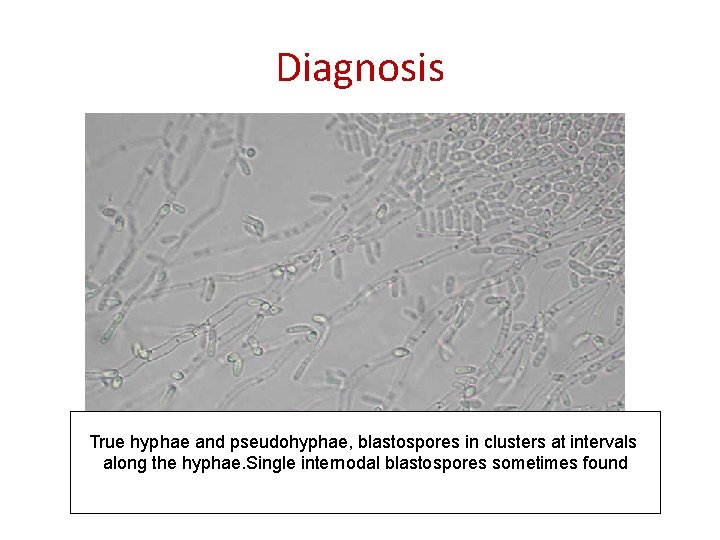 Diagnosis True hyphae and pseudohyphae, blastospores in clusters at intervals along the hyphae. Single