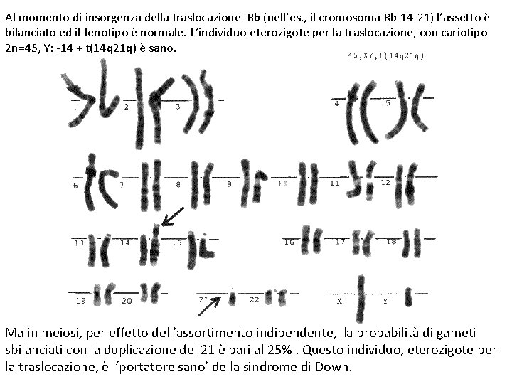 Al momento di insorgenza della traslocazione Rb (nell’es. , il cromosoma Rb 14 -21)