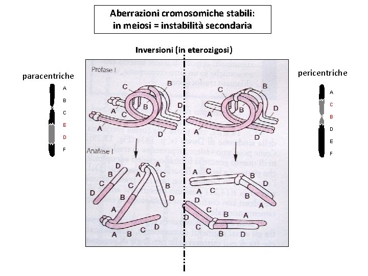 Aberrazioni cromosomiche stabili: in meiosi = instabilità secondaria Inversioni (in eterozigosi) paracentriche A B