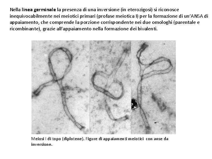 Nella linea germinale la presenza di una inversione (in eterozigosi) si riconosce inequivocabilmente nei