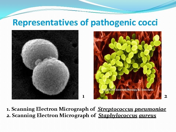 Representatives of pathogenic cocci 1 2 1. Scanning Electron Micrograph of Streptococcus pneumoniae 2.
