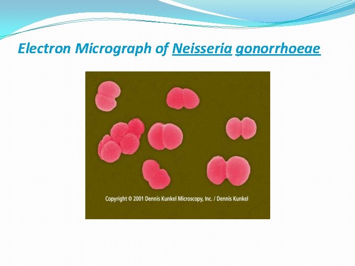 Electron Micrograph of Neisseria gonorrhoeae 