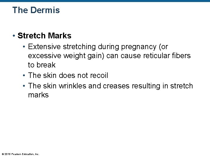 The Dermis • Stretch Marks • Extensive stretching during pregnancy (or excessive weight gain) The Dermis • Stretch Marks • Extensive stretching during pregnancy (or excessive weight gain)