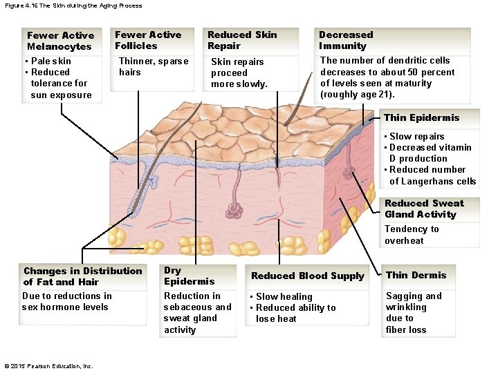 Figure 4. 16 The Skin during the Aging Process Fewer Active Melanocytes • Pale Figure 4. 16 The Skin during the Aging Process Fewer Active Melanocytes • Pale