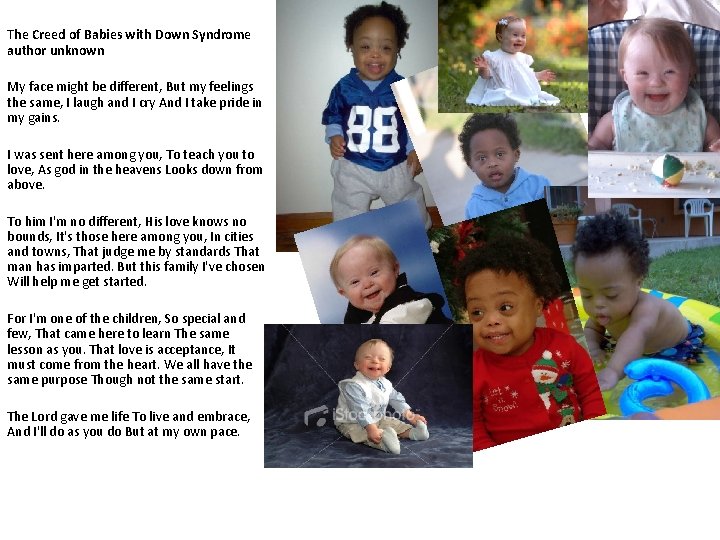 The Creed of Babies with Down Syndrome author unknown My face might be different,
