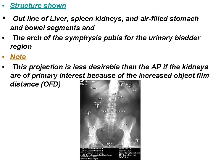  • Structure shown • Out line of Liver, spleen kidneys, and air-filled stomach