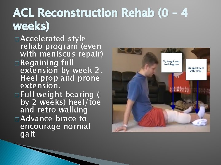 ACL Reconstruction Rehab (0 – 4 weeks) � Accelerated style rehab program (even with