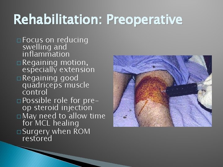 Rehabilitation: Preoperative � Focus on reducing swelling and inflammation � Regaining motion, especially extension