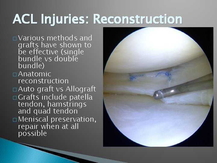 ACL Injuries: Reconstruction � Various methods and grafts have shown to be effective (single