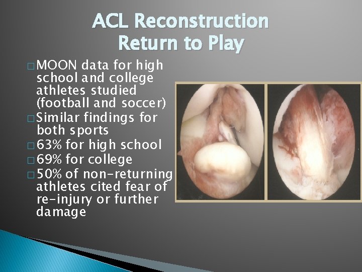 � MOON ACL Reconstruction Return to Play data for high school and college athletes