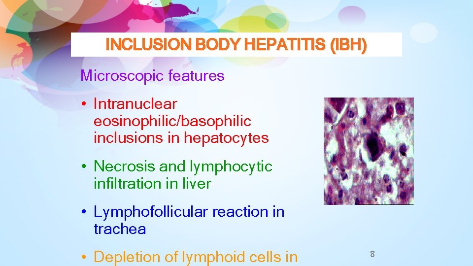 INCLUSION BODY HEPATITIS (IBH) Microscopic features • Intranuclear eosinophilic/basophilic inclusions in hepatocytes • Necrosis