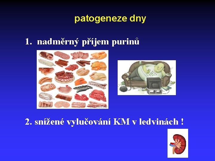 patogeneze dny 1. nadměrný příjem purinů 2. snížené vylučování KM v ledvinách ! 