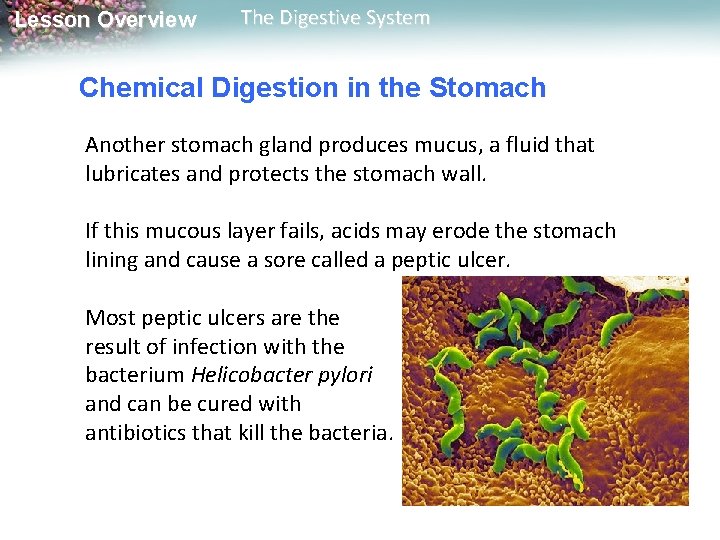 Lesson Overview The Digestive System Chemical Digestion in the Stomach Another stomach gland produces Lesson Overview The Digestive System Chemical Digestion in the Stomach Another stomach gland produces