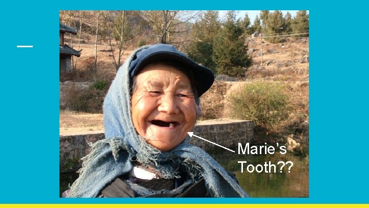 Marie’s Tooth? ? 