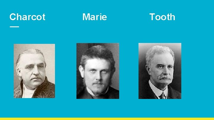 Charcot Marie Tooth 