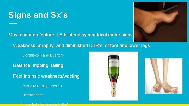 Signs and Sx’s Most common feature: LE bilateral symmetrical motor signs Weakness, atrophy, and