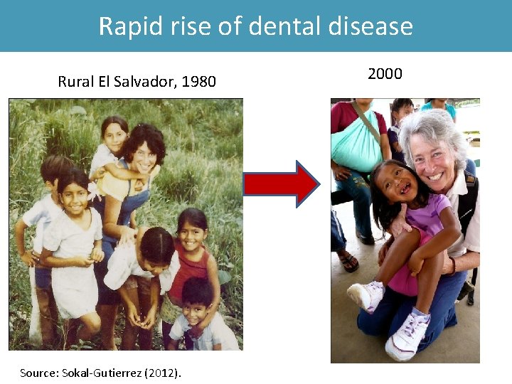 Rapid rise of dental disease Rural El Salvador, 1980 Source: Sokal-Gutierrez (2012). 2000 