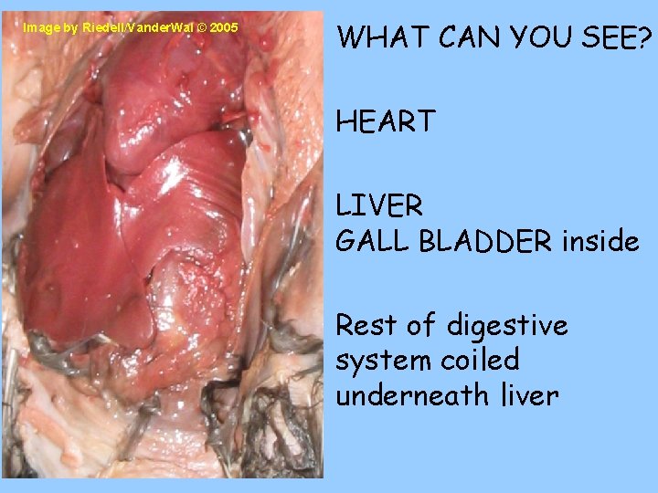 Image by Riedell/Vander. Wal © 2005 WHAT CAN YOU SEE? HEART LIVER GALL BLADDER