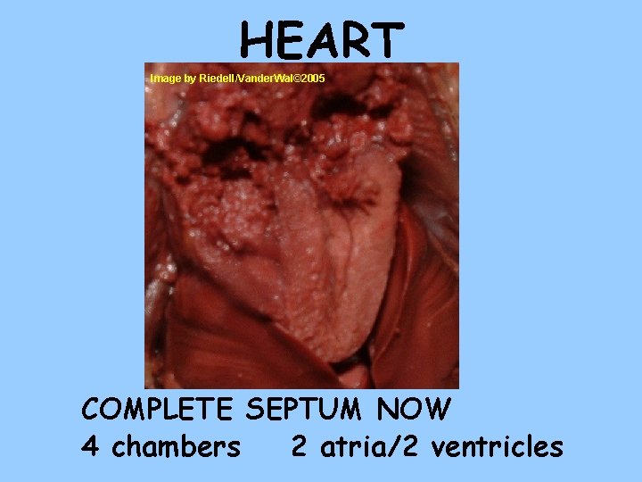 HEART Image by Riedell/Vander. Wal© 2005 COMPLETE SEPTUM NOW 4 chambers 2 atria/2 ventricles