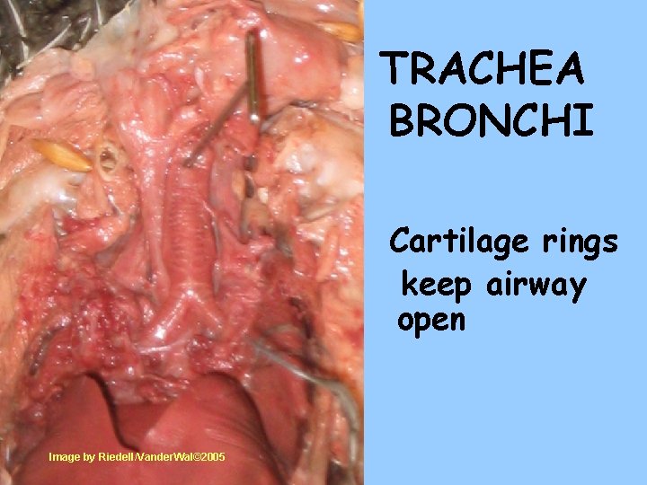 TRACHEA BRONCHI Cartilage rings keep airway open Image by Riedell/Vander. Wal© 2005 