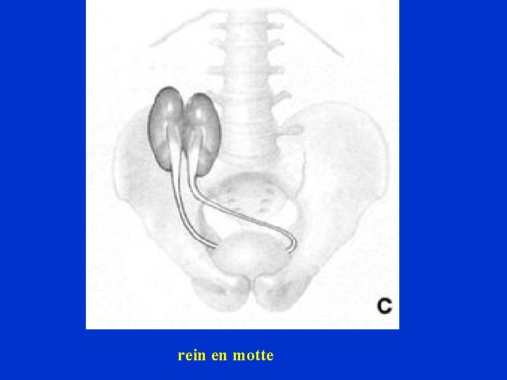 rein en motte 
