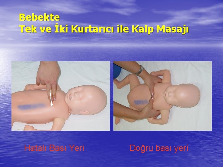 Bebekte Tek ve İki Kurtarıcı ile Kalp Masajı Hatalı Bası Yeri Doğru bası yeri