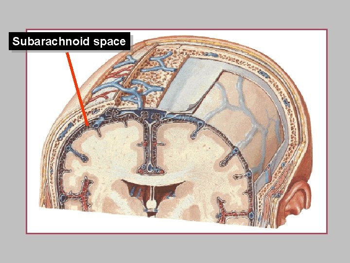 Subarachnoid space 