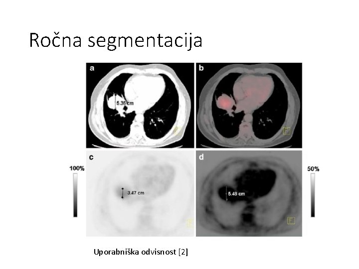 Ročna segmentacija Uporabniška odvisnost [2] 