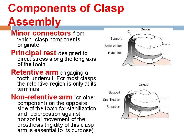 Components of Clasp Assembly Minor connectors from which clasp components originate. Principal rest designed