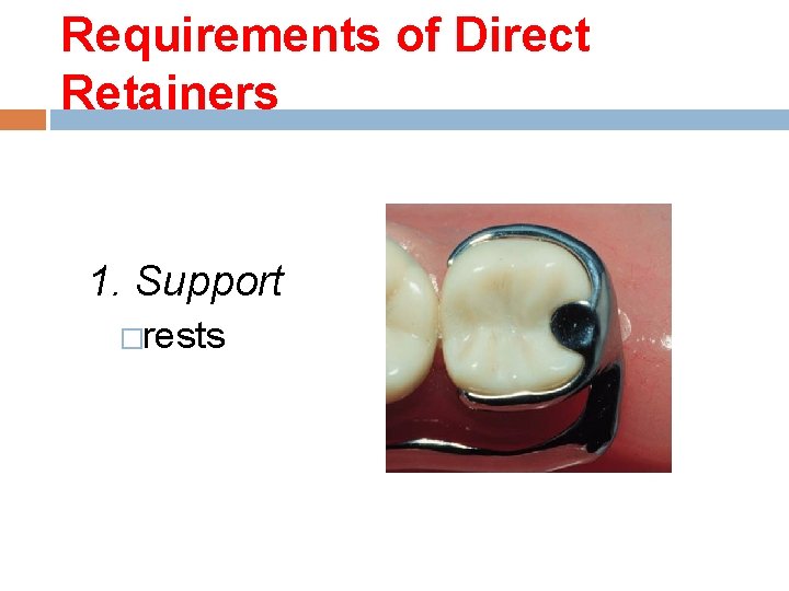 Requirements of Direct Retainers 1. Support �rests 
